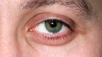 Strained eye